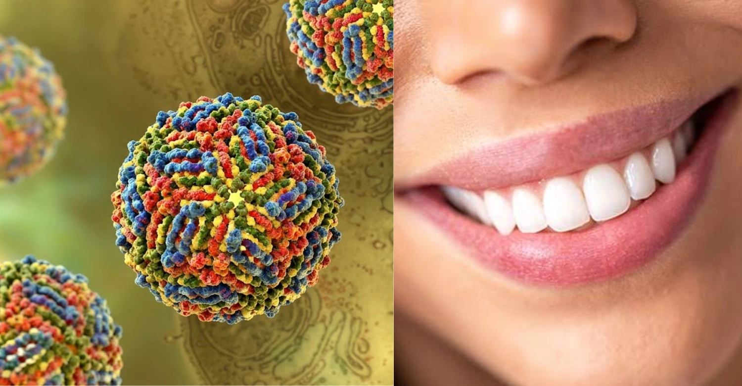 West Nile Virus and Oral Health 2